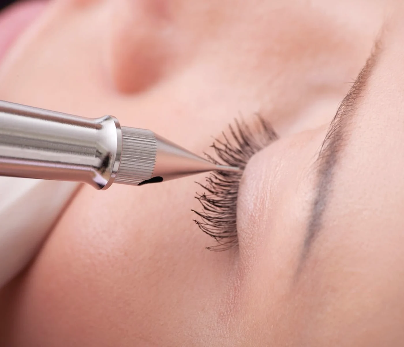 Wimpernkranzverdichtung in Braunschweig – Bildmotiv 2